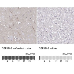 CEP170B Antibody, Novus Biologicals 25 &mu;L, Unlabeled:Antibodies, Polyclonal